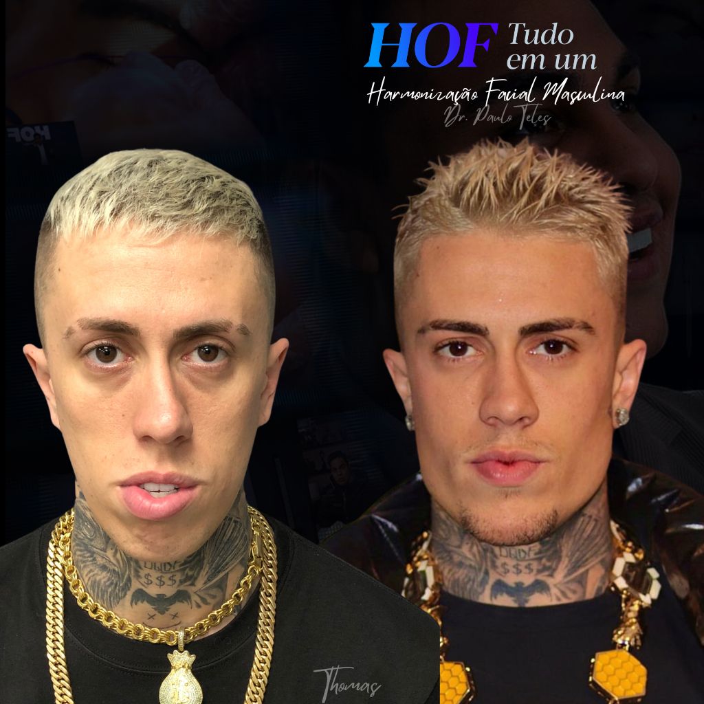 Hof tudo em um