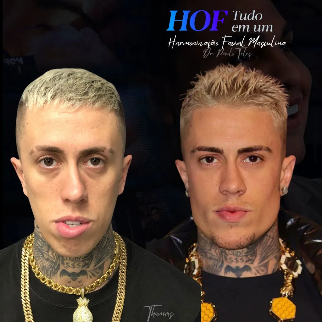 Hof tudo em um